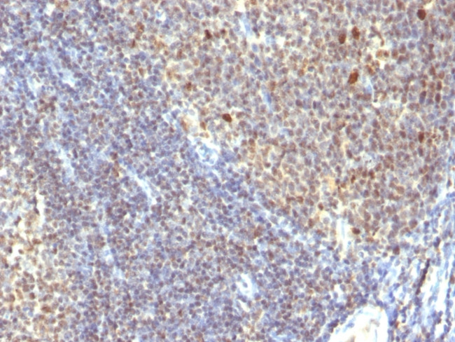 IPO-38 (Proliferation Marker) Antibody in Immunohistochemistry (Paraffin) (IHC (P))