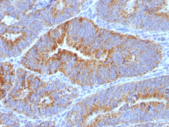 Thomsen-Friedenreich Antigen/CD176 (Pan Carcinoma Marker) Antibody in Immunohistochemistry (Paraffin) (IHC (P))