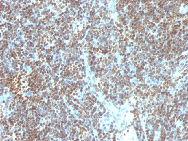 Double Stranded DNA (dsDNA) (Nuclear Marker) Antibody in Immunohistochemistry (Paraffin) (IHC (P))