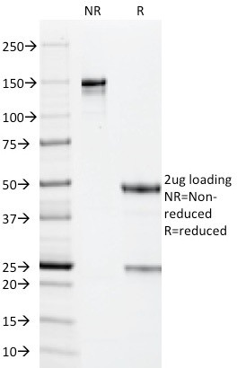 Cytomegalovirus p65 (CMV-p65) Antibody in SDS-PAGE (SDS-PAGE)