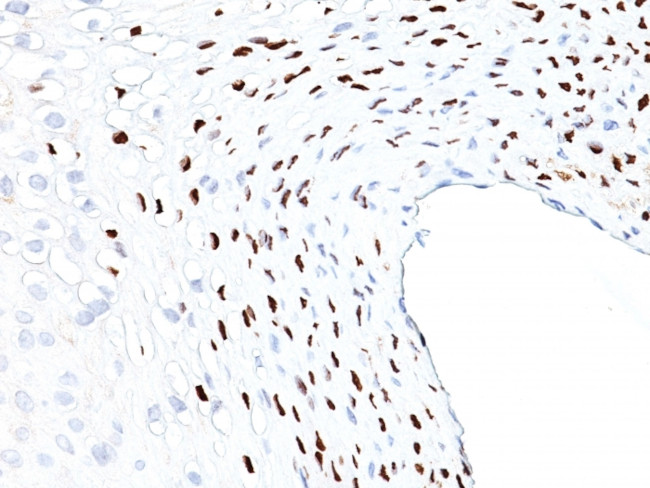 HPV-16 (Human Papilloma Virus 16) Antibody in Immunohistochemistry (Paraffin) (IHC (P))