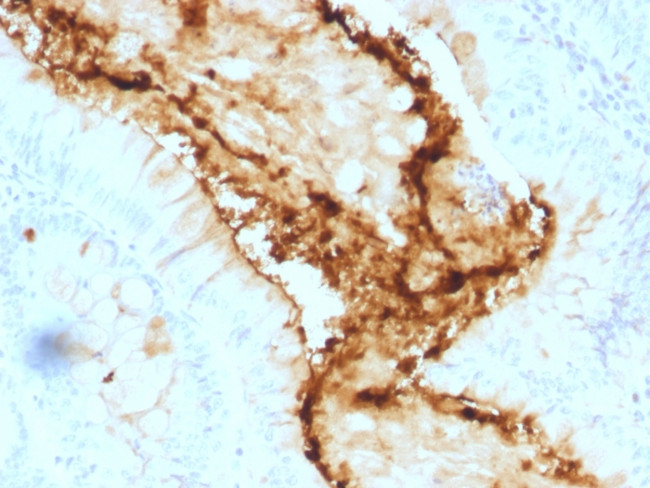 Lewis Y (Tumor Marker) Antibody in Immunohistochemistry (Paraffin) (IHC (P))