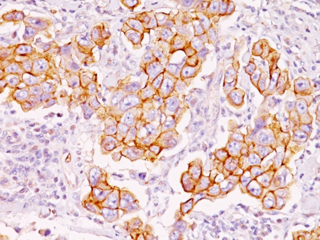 Phosphotyrosine (P-Tyr) Antibody in Immunohistochemistry (Paraffin) (IHC (P))