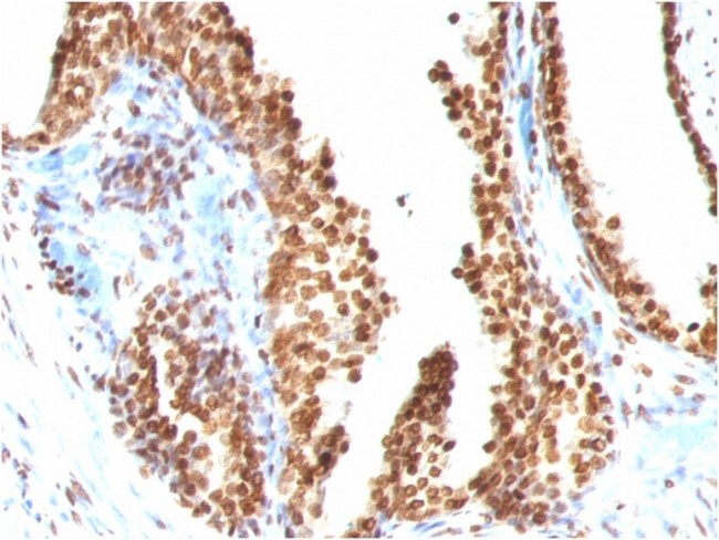 Double Stranded DNA (dsDNA) (Nuclear Marker) Antibody in Immunohistochemistry (Paraffin) (IHC (P))