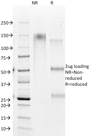 Hepatocyte Specific Antigen (Hepatocellular Marker) Antibody in SDS-PAGE (SDS-PAGE)