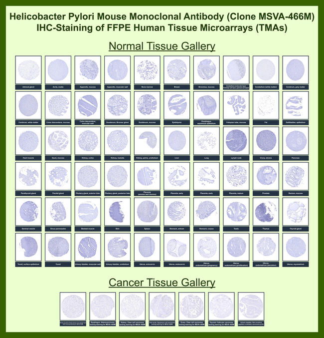 Helicobacter pylori (Catalase) Antibody in Immunohistochemistry (Paraffin) (IHC (P))