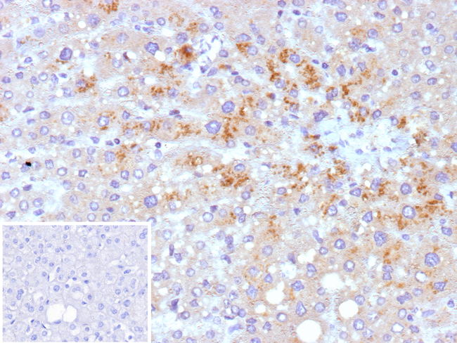 Hepatitis C virus NS3 (Nonstructural protein 3) Antibody in Immunohistochemistry (Paraffin) (IHC (P))