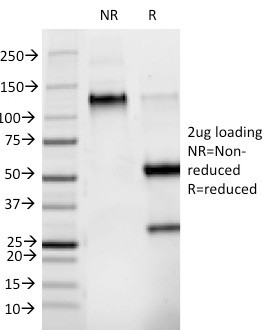 Phosphotyrosine (P-Tyr) Antibody in SDS-PAGE (SDS-PAGE)