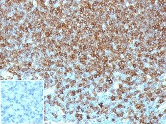 Pan-HLA-II (DP, DQ, DR) Antibody in Immunohistochemistry (Paraffin) (IHC (P))