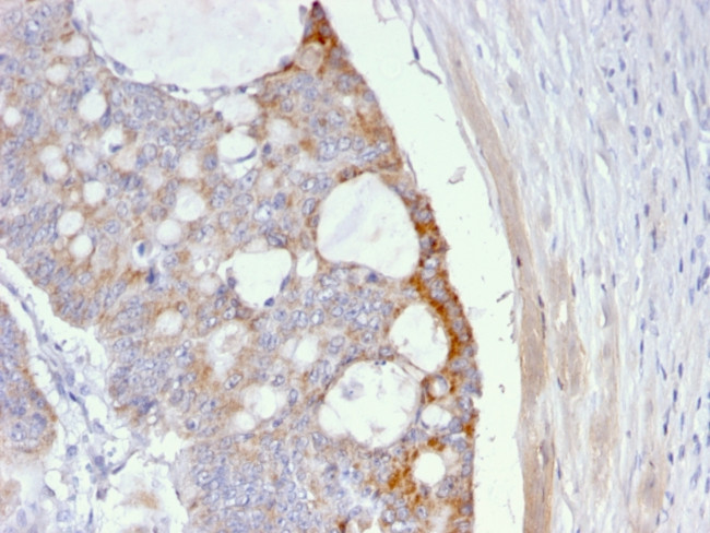 Thomsen-Friedenreich Antigen/CD176 (Pan Carcinoma Marker) Antibody in Immunohistochemistry (Paraffin) (IHC (P))