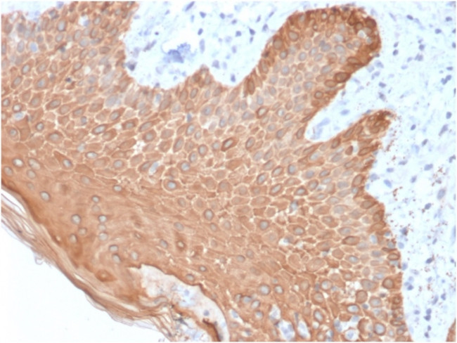 Cytokeratin, Multi (Epithelial Marker) Antibody in Immunohistochemistry (Paraffin) (IHC (P))
