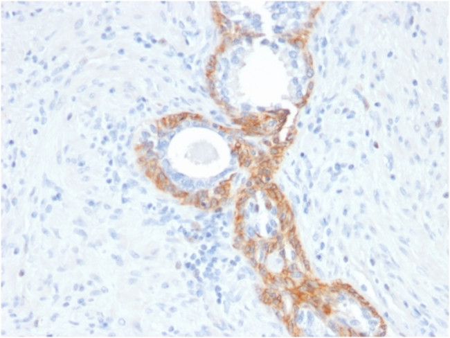 Cytokeratin, Basic (Type II or HMW) Antibody in Immunohistochemistry (Paraffin) (IHC (P))