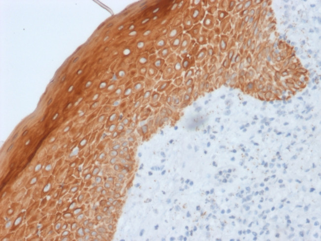 Cytokeratin 5/6/18 Antibody in Immunohistochemistry (Paraffin) (IHC (P))