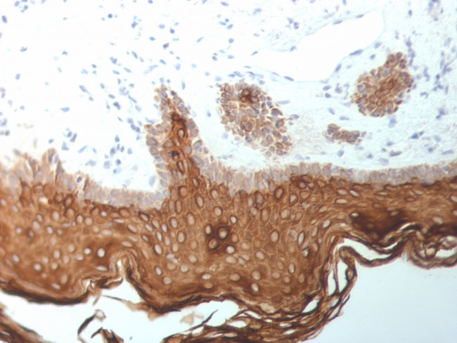 Cytokeratin 5/6/18 Antibody in Immunohistochemistry (Paraffin) (IHC (P))