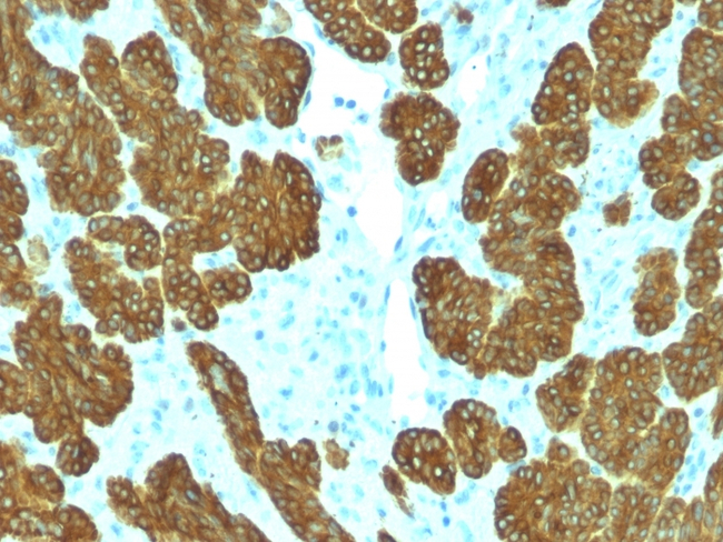 Cytokeratin 5/6 (Basal, Myoepithelial & Mesothelial Cell Marker) Antibody in Immunohistochemistry (Paraffin) (IHC (P))
