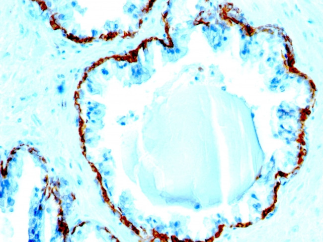 Cytokeratin, Basic (Type II or HMW) Antibody in Immunohistochemistry (Paraffin) (IHC (P))