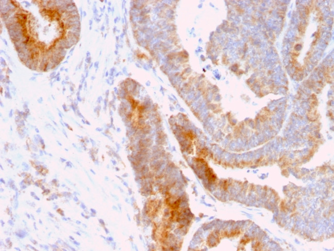 Thomsen-Friedenreich Antigen/CD176 (Pan Carcinoma Marker) Antibody in Immunohistochemistry (Paraffin) (IHC (P))