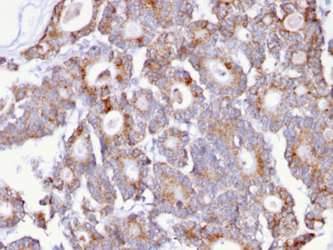 Thomsen-Friedenreich Antigen/CD176 (Pan Carcinoma Marker) Antibody in Immunohistochemistry (Paraffin) (IHC (P))