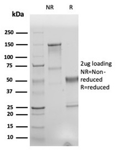 Human Nuclear Antigen (HNA) (Human Cell Marker) Antibody in SDS-PAGE (SDS-PAGE)