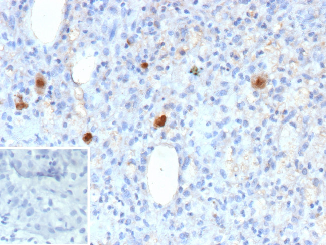 Cytomegalovirus p65 (CMV-p65) Antibody in Immunohistochemistry (Paraffin) (IHC (P))