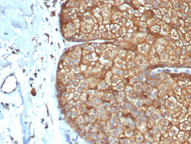 Cytokeratin, Type I (Epithelial Marker) Antibody in Immunohistochemistry (Paraffin) (IHC (P))