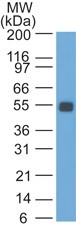 Ep-CAM/CD326 (Rat) Antibody in Western Blot (WB)