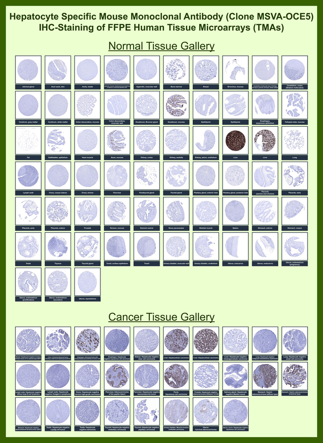 Hepatocyte Specific Antigen (Hepatocellular Marker) Antibody in Immunohistochemistry (Paraffin) (IHC (P))