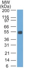 Ep-CAM/CD326 (Rat) Antibody in Western Blot (WB)