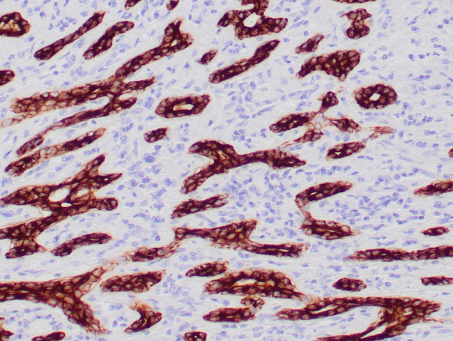 Cytokeratin (CAM5.2) (Epithelial Marker) Antibody in Immunohistochemistry (Paraffin) (IHC (P))