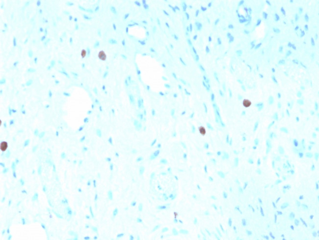 HPV-16 (Human Papilloma Virus 16) Antibody in Immunohistochemistry (Paraffin) (IHC (P))