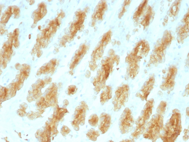 Cytokeratin, Acidic (Type I or LMW) Antibody in Immunohistochemistry (Paraffin) (IHC (P))