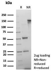 Double Stranded DNA (dsDNA) (Nuclear Marker) Antibody in Immunohistochemistry (Paraffin) (IHC (P))