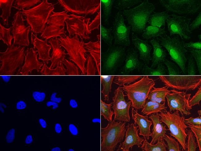 MSMB Antibody in Immunocytochemistry (ICC/IF)