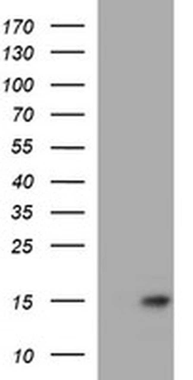 MSMB Antibody in Western Blot (WB)