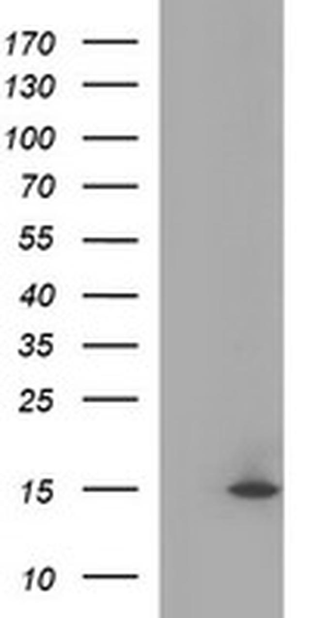 MSMB Antibody in Western Blot (WB)