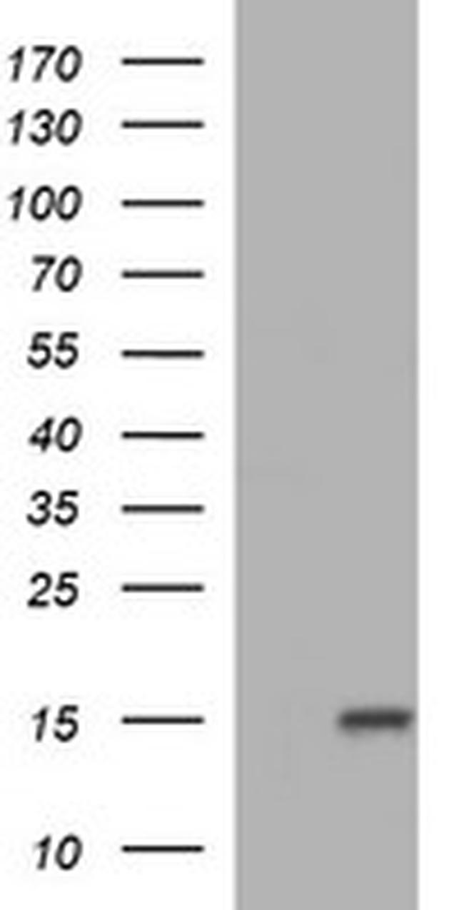 MSMB Antibody in Western Blot (WB)