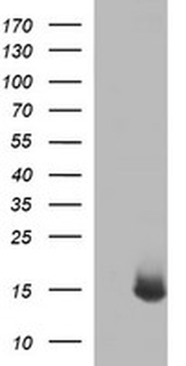 MSMB Antibody in Western Blot (WB)