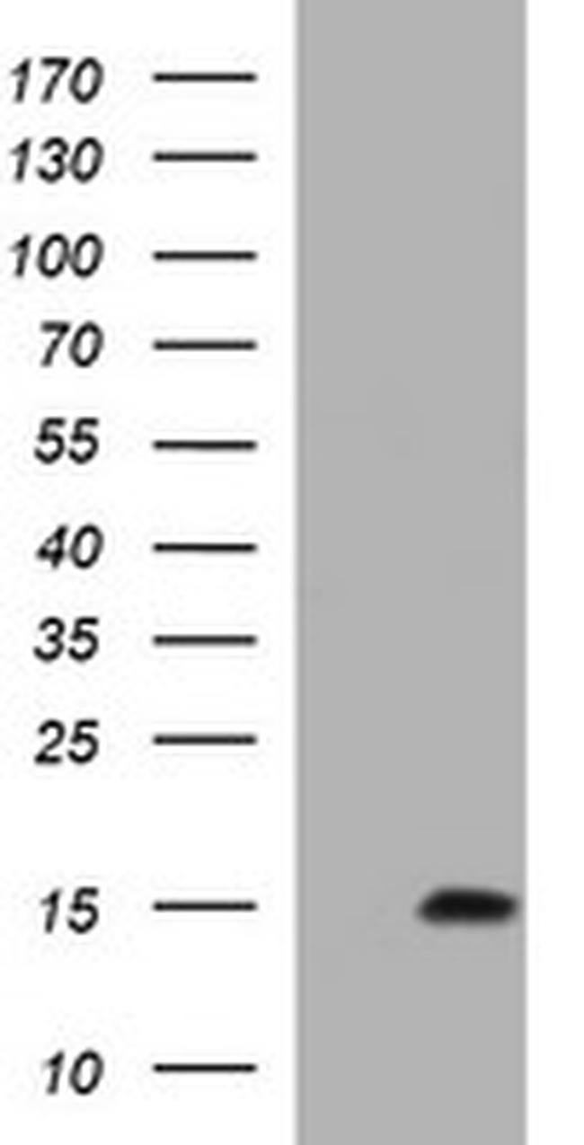 MSMB Antibody in Western Blot (WB)