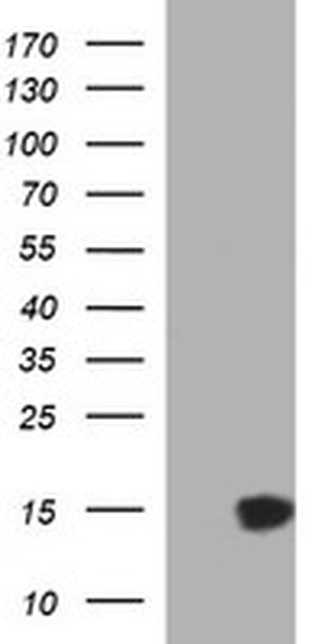 MSMB Antibody in Western Blot (WB)