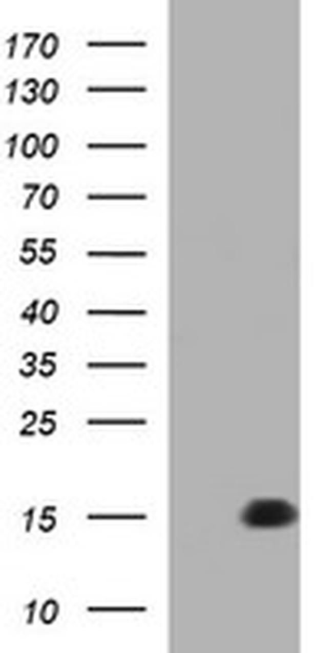 MSMB Antibody in Western Blot (WB)