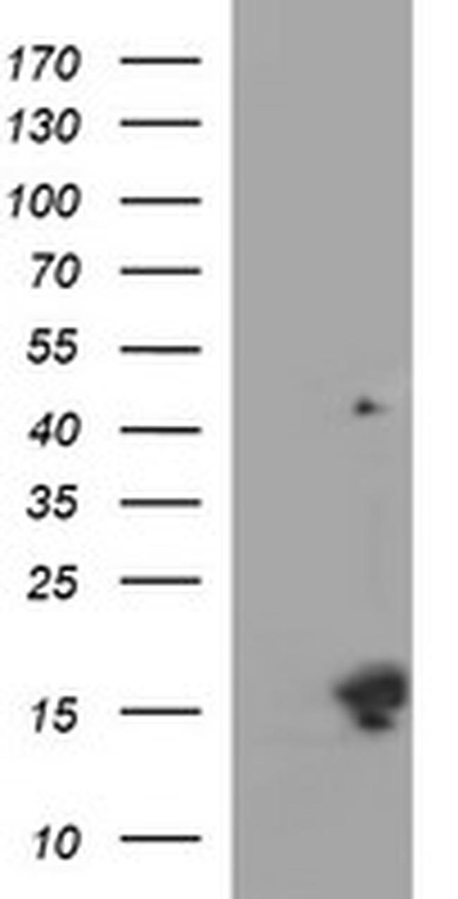 MSMB Antibody in Western Blot (WB)