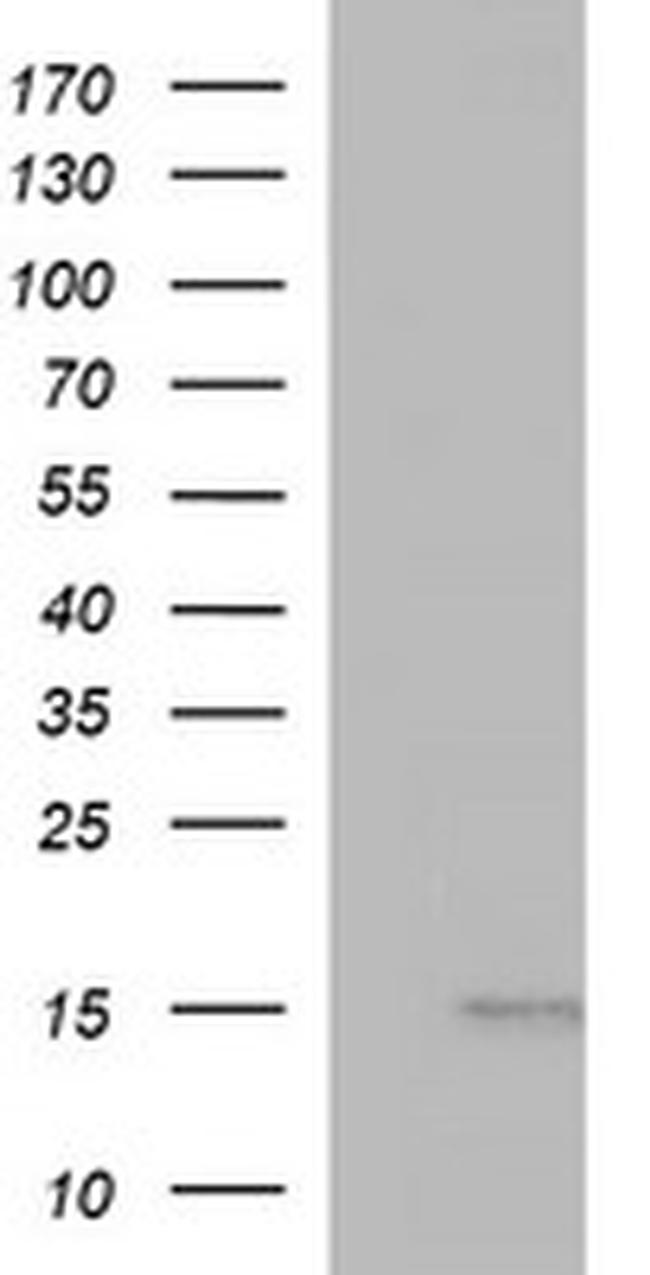 MSMB Antibody in Western Blot (WB)