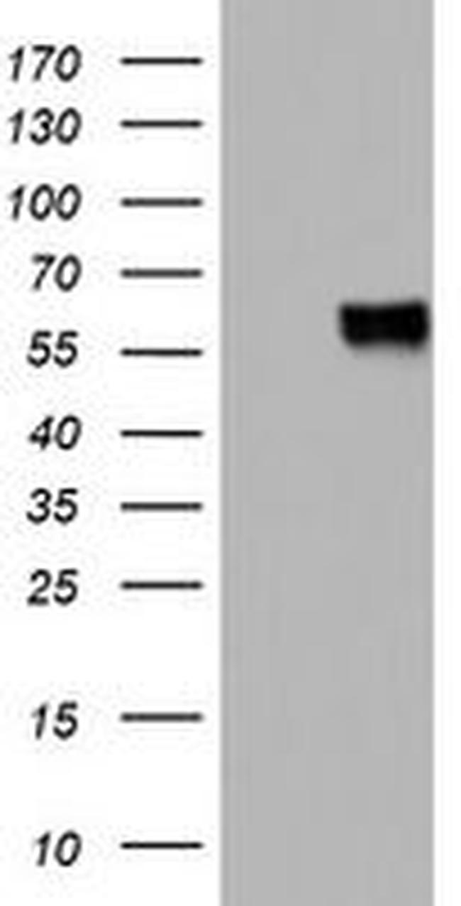 MSR1 Antibody in Western Blot (WB)