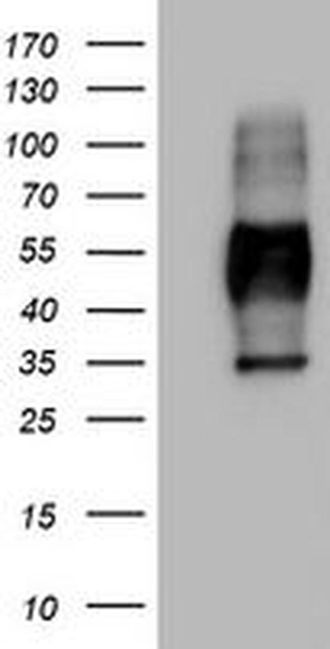 MSR1 Antibody in Western Blot (WB)