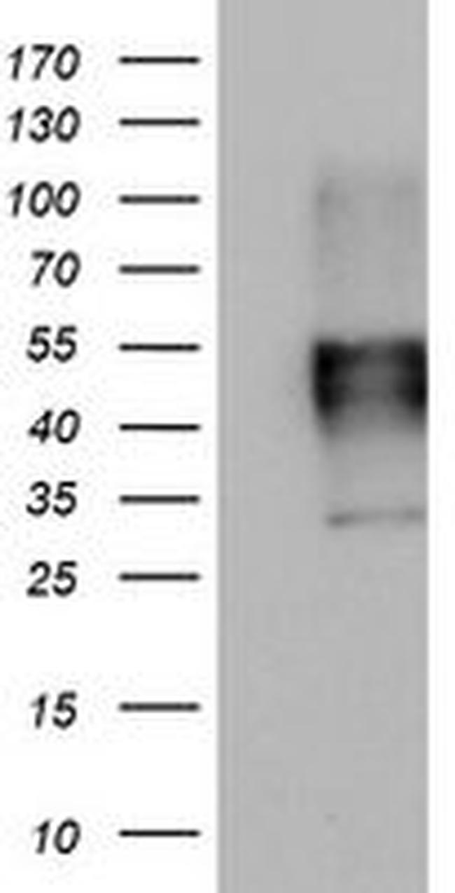 MSR1 Antibody in Western Blot (WB)