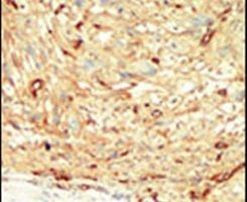 MST1 Antibody in Immunohistochemistry (IHC)