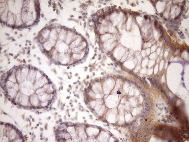 MST1 Antibody in Immunohistochemistry (Paraffin) (IHC (P))