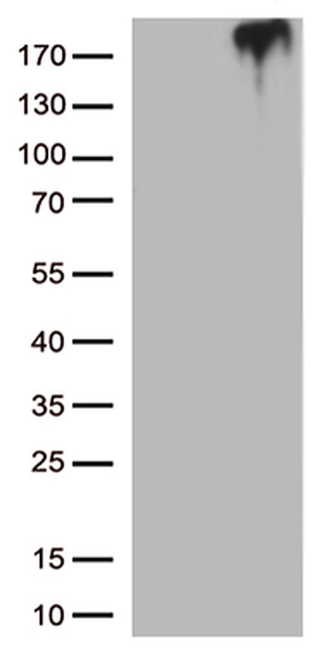 MST1R Antibody in Western Blot (WB)