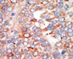 MST3 Antibody in Immunohistochemistry (IHC)