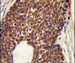 MTBP Antibody in Immunohistochemistry (IHC)